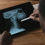 Aplicativos grátis de raio-x pelo celular